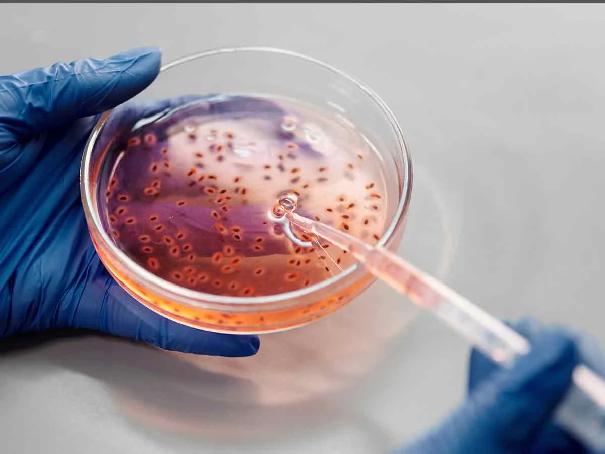 Lees meer over het artikel Bacteriën – wat willen ze – versus wat ú nodig hebt